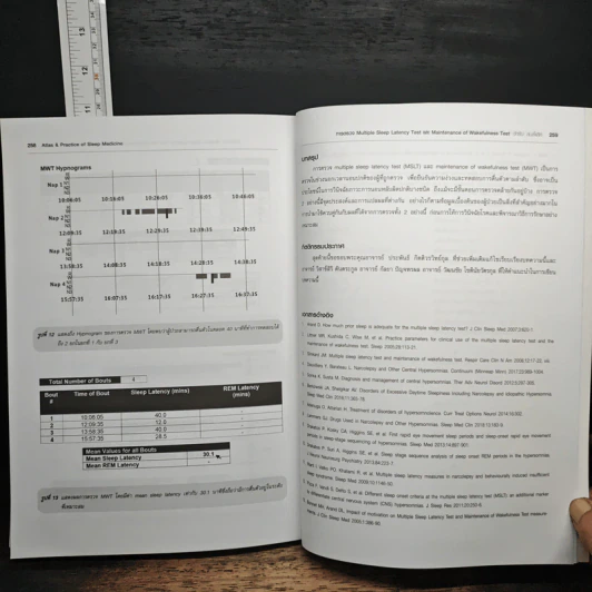 Atlas & Practice of Sleep Medicine - กัลยา ปัญจพรผล รูปที่ 10