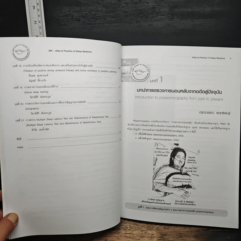 Atlas & Practice of Sleep Medicine - กัลยา ปัญจพรผล รูปที่ 9