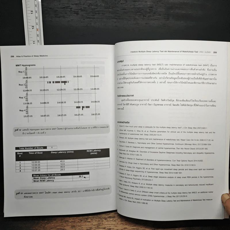 Atlas & Practice of Sleep Medicine - กัลยา ปัญจพรผล รูปที่ 10