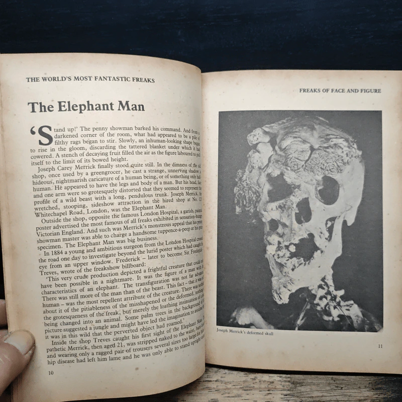 The World's Most Fantastic Freaks - Mike Parker รูปที่ 8