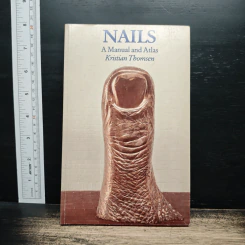 Nails: A Manual and Atlas - Kristian Thomsen