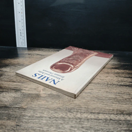 Nails: A Manual and Atlas - Kristian Thomsen รูปที่ 5