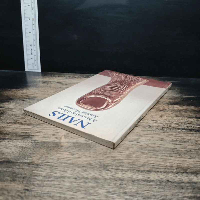 Nails: A Manual and Atlas - Kristian Thomsen รูปที่ 5