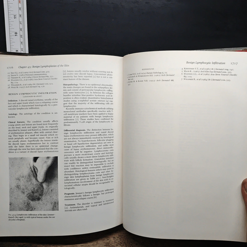 Textbook of Dermatology Vol.2 รูปที่ 11