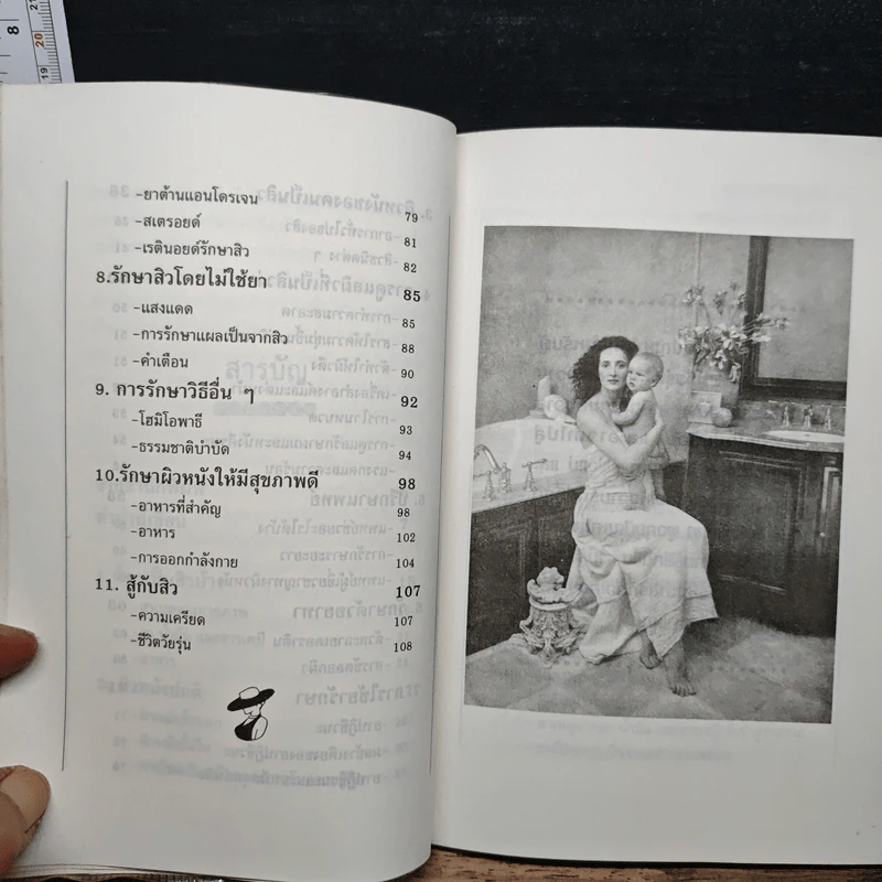 สิวกับการรักษาตนเอง - ดร.สุดา เรียงโรจน์พิทักษ์ รูปที่ 8