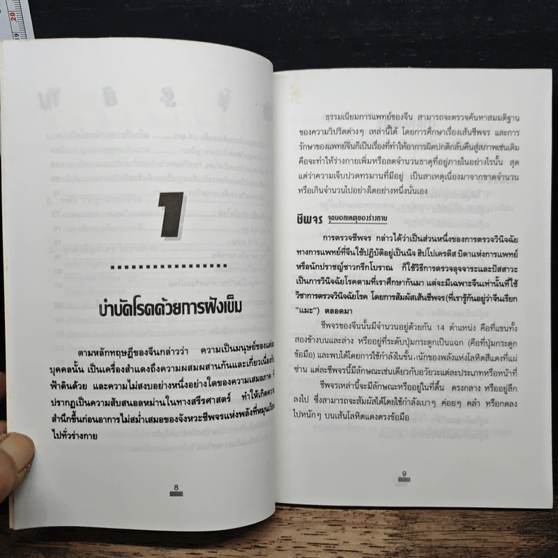 ฝังเข็มรักษาโรค - อ.วุฒินันท์ พิริยะพงษ์กุล รูปที่ 8