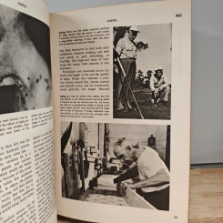 Fishbein's Illustrated Medical and Health Encyclopedia Vol.1-2,4 รูปที่ 10