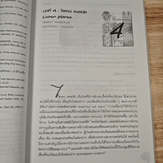 เวชศาสตร์ช่องปากขั้นสูง รูปที่ 9
