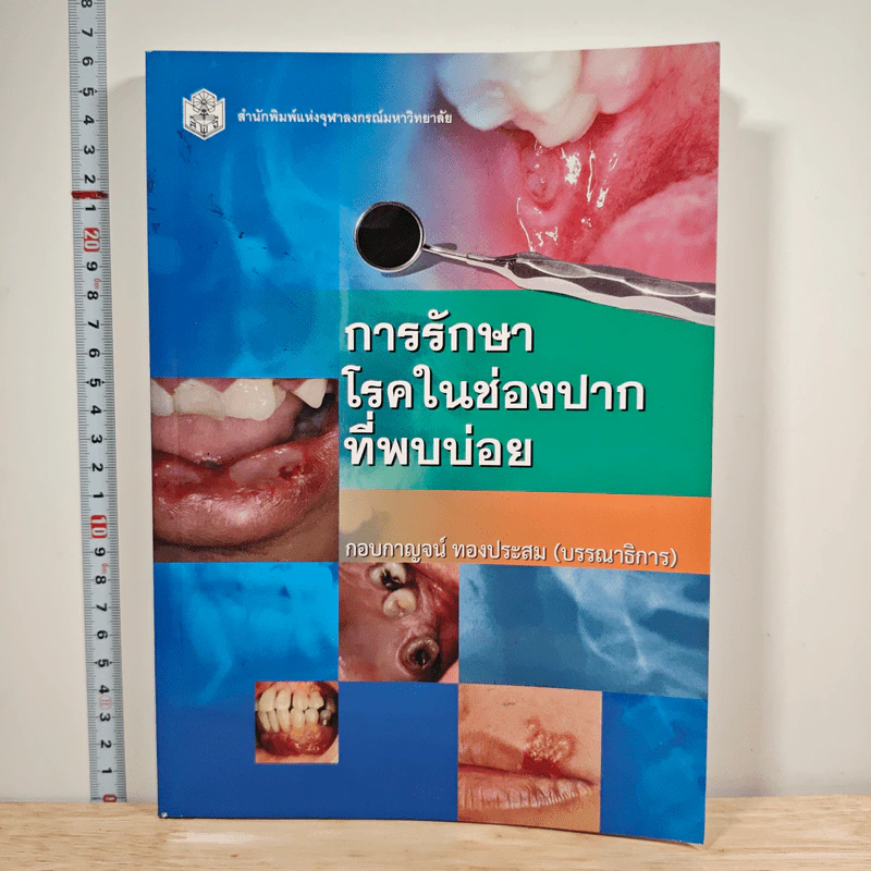 การรักษาโรคในช่องปากที่พบบ่อย - กอบกาญจน์ ทองประสม รูปที่ 1
