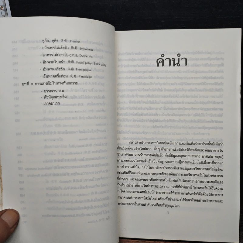 แทงเข็ม - อภิชัย ขัยดรุณ รูปที่ 11