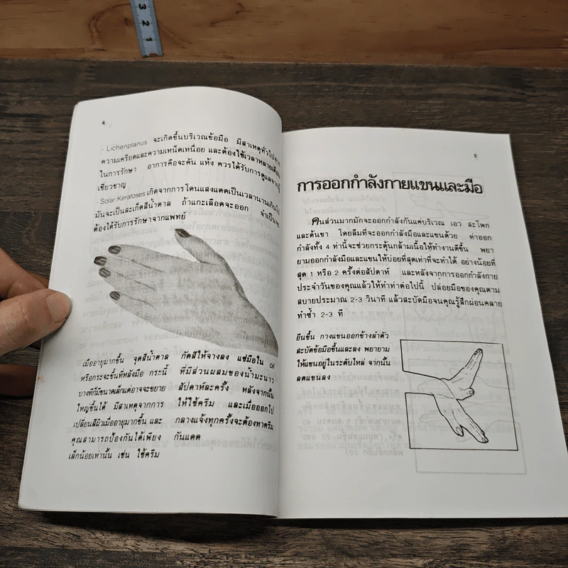 ดูแลถนอมสุขภาพ มือ และ ขา - สุกัญญา รูปที่ 8