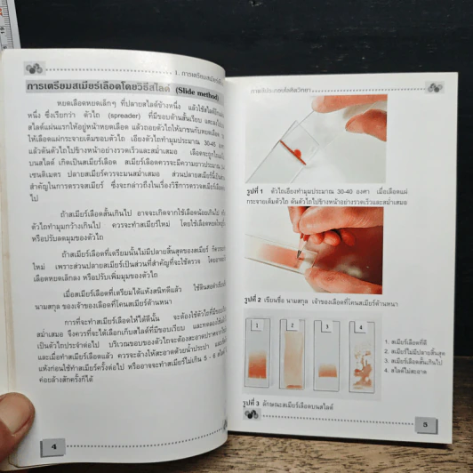โลหิตวิทยา Hematology - สุภินันท์ สเป็ค-สายเชื้อ รูปที่ 10