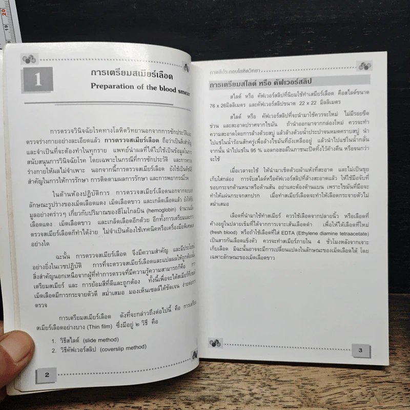 โลหิตวิทยา Hematology - สุภินันท์ สเป็ค-สายเชื้อ รูปที่ 9