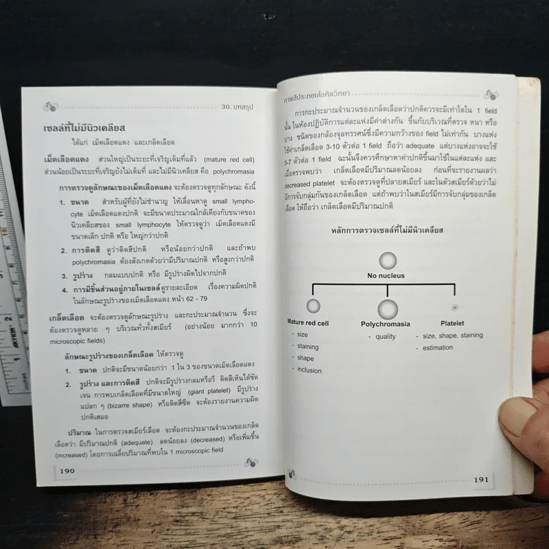 โลหิตวิทยา Hematology - สุภินันท์ สเป็ค-สายเชื้อ รูปที่ 11