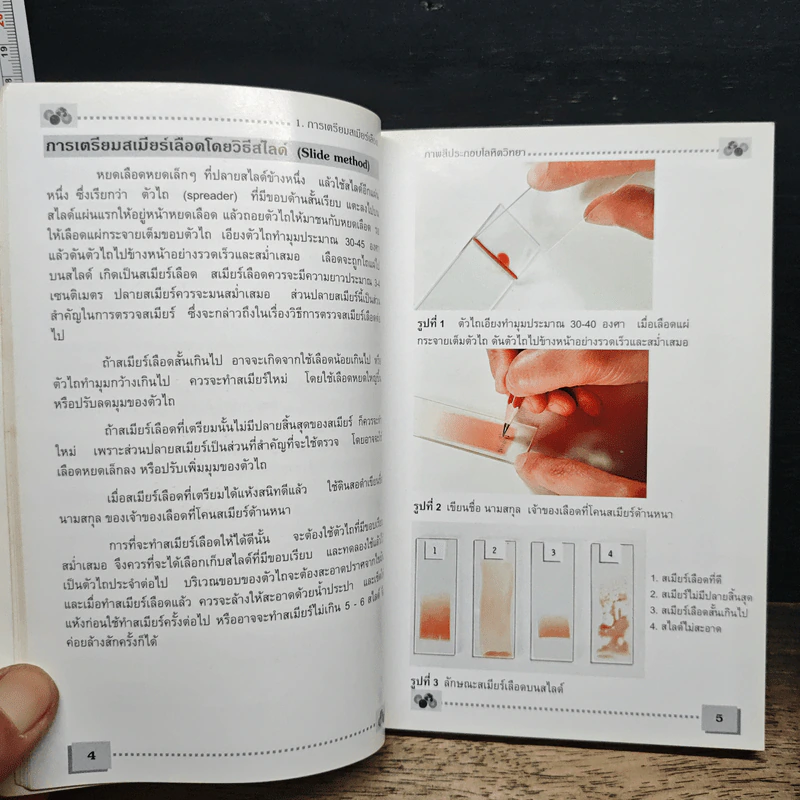 โลหิตวิทยา Hematology - สุภินันท์ สเป็ค-สายเชื้อ รูปที่ 10