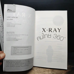 X-Ray คนไทย 360 ํ - พงษ์ ผาวิจิตร รูปที่ 6