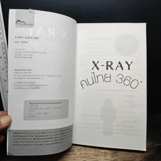 X-Ray คนไทย 360 ํ - พงษ์ ผาวิจิตร รูปที่ 6