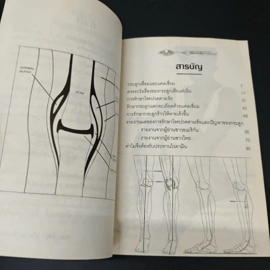 ปัญหาข้อกระดูก - พ.อ.หญิง ศรีนวล เจียจันทร์พงษ์ รูปที่ 6