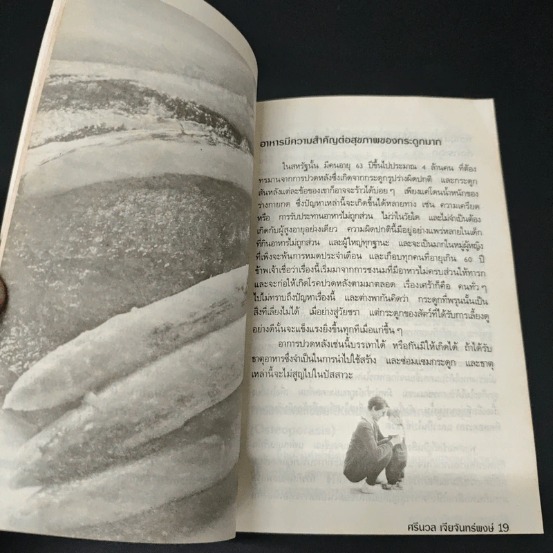 ปัญหาข้อกระดูก - พ.อ.หญิง ศรีนวล เจียจันทร์พงษ์ รูปที่ 8