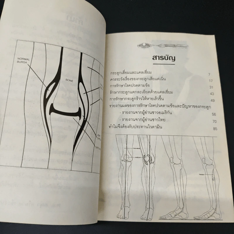 ปัญหาข้อกระดูก - พ.อ.หญิง ศรีนวล เจียจันทร์พงษ์ รูปที่ 6