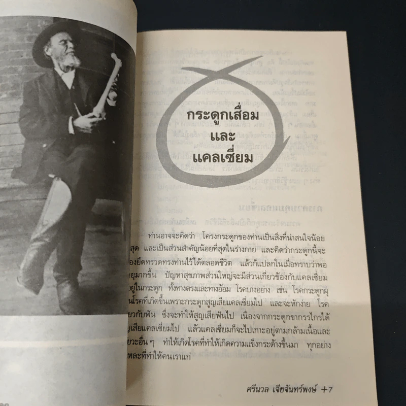 ปัญหาข้อกระดูก - พ.อ.หญิง ศรีนวล เจียจันทร์พงษ์ รูปที่ 6