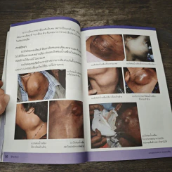 รู้ทันมะเร็ง 2 ฉบับสมบูรณ์ - อัศวิน ทองประเสริฐ รูปที่ 8
