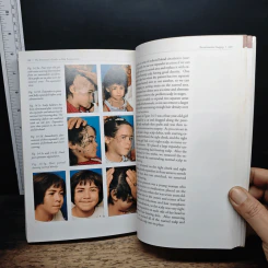 The Everyman's Guide to Hair Replacement รูปที่ 9