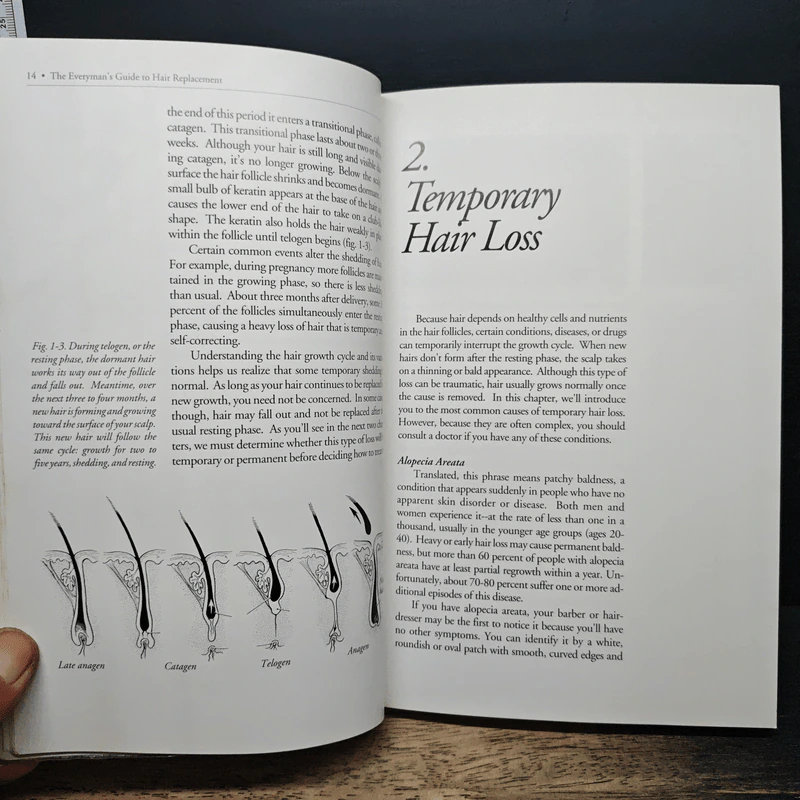 The Everyman's Guide to Hair Replacement รูปที่ 8