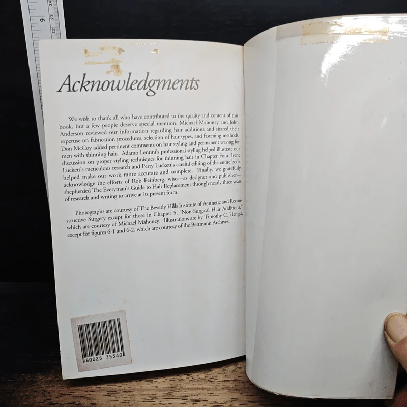The Everyman's Guide to Hair Replacement รูปที่ 10