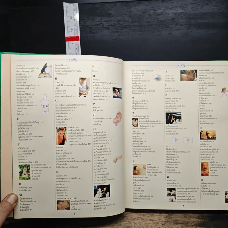 ความรู้เรื่องโรค ทางแก้ ดูแล ป้องกัน - รีดเดอร์ส ไดเจสท์ รูปที่ 7