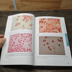 Handbook of Infectious Disease - รุจิภาส สิริจตุภัทร รูปที่ 9