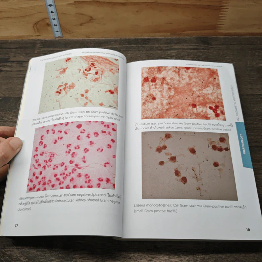 Handbook of Infectious Disease - รุจิภาส สิริจตุภัทร รูปที่ 9