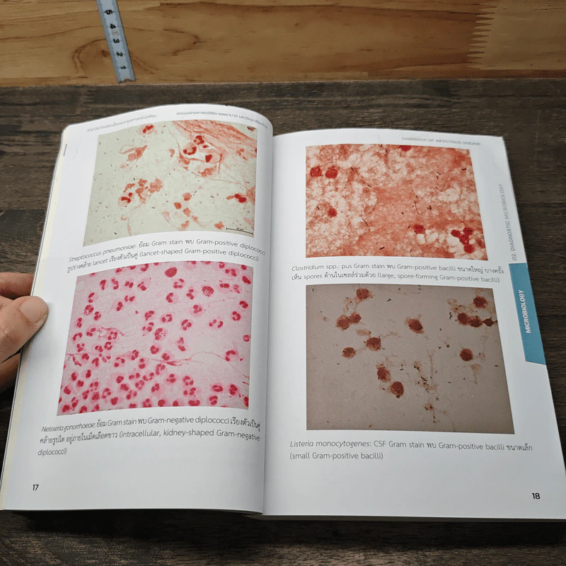 Handbook of Infectious Disease - รุจิภาส สิริจตุภัทร รูปที่ 9