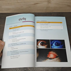 จักษุจุฬา CHULA EYE BOOK รูปที่ 8
