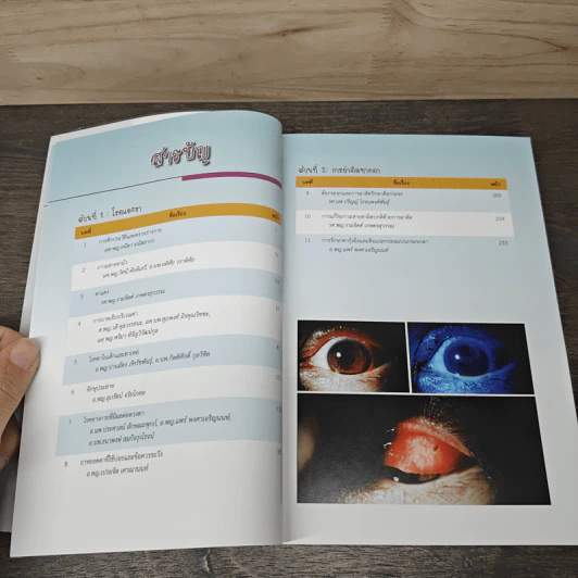 จักษุจุฬา CHULA EYE BOOK รูปที่ 8