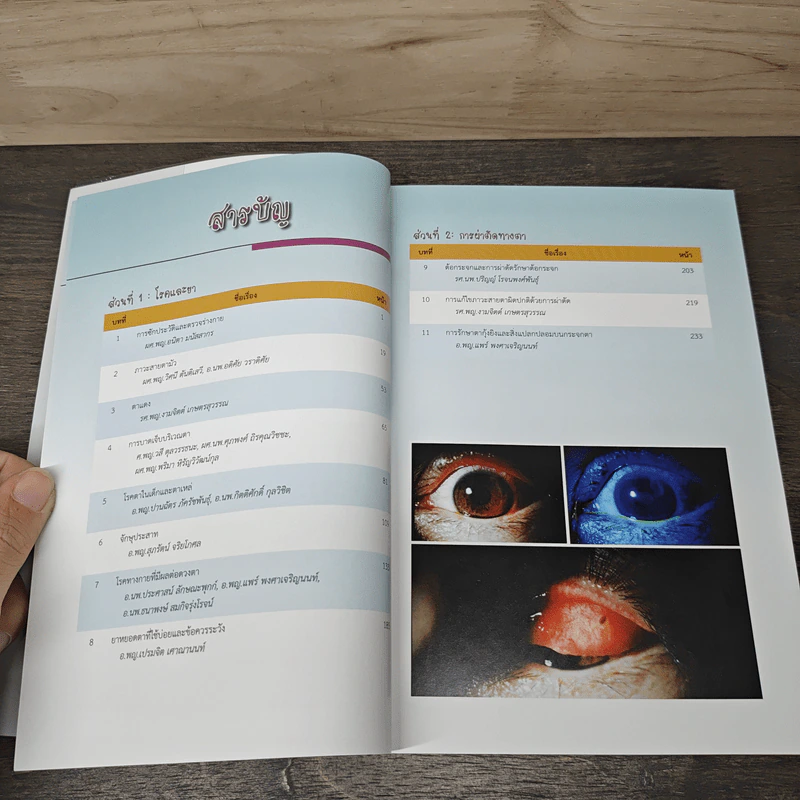 จักษุจุฬา CHULA EYE BOOK รูปที่ 8