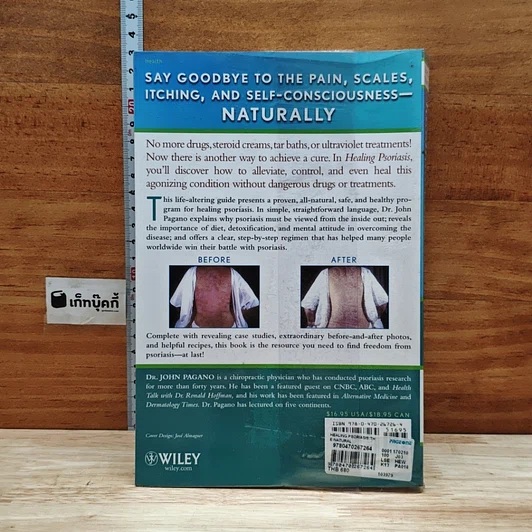 Healing Psoriasis: The Natural Alternative รูปที่ 2