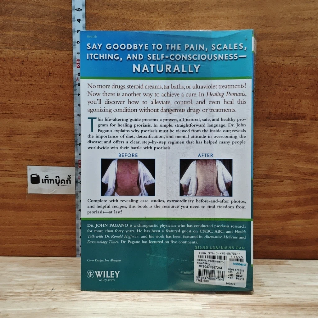 Healing Psoriasis: The Natural Alternative รูปที่ 2