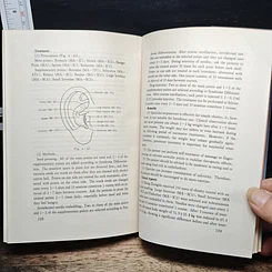Auricular Acupuncture Therapy รูปที่ 10