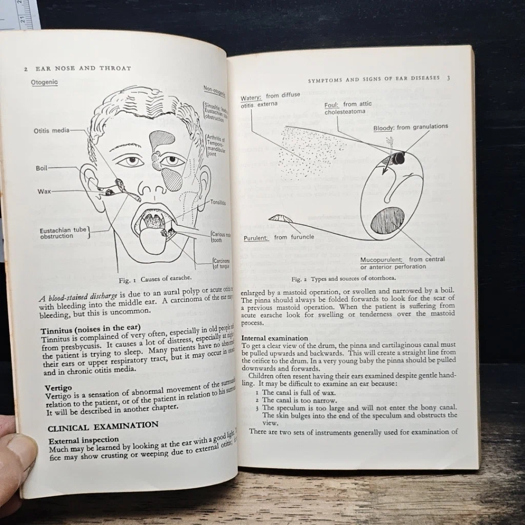 A Short Textbook: Ear, Nose and Throat รูปที่ 8