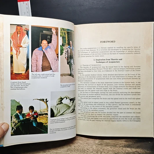 หนังสือ Scalp Acupuncture and Clinical Cases รูปที่ 8
