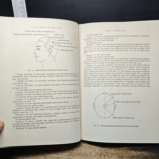 หนังสือ Scalp Acupuncture and Clinical Cases รูปที่ 9