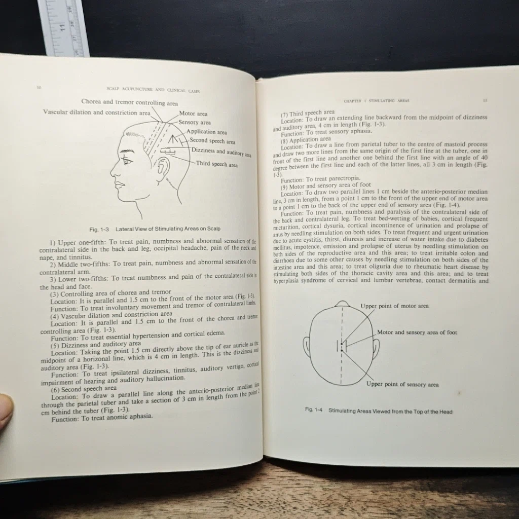หนังสือ Scalp Acupuncture and Clinical Cases รูปที่ 9