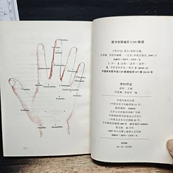 Hand Acupuncture Therapy รูปที่ 11