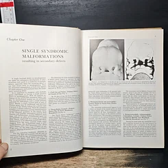 หนังสือ Recognizable Patterns of Human Malformation รูปที่ 9
