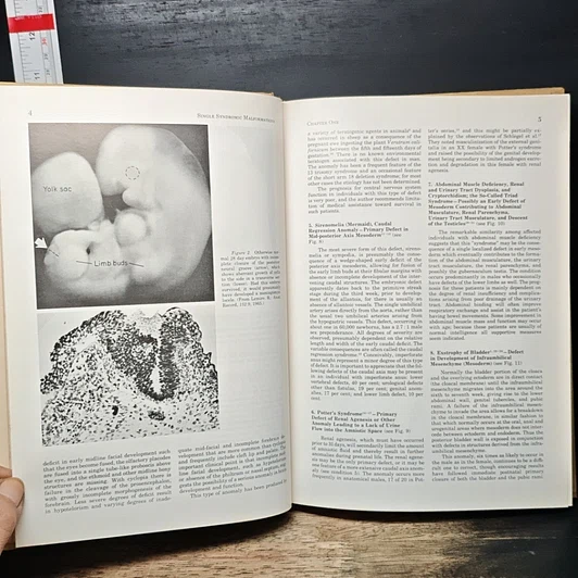 หนังสือ Recognizable Patterns of Human Malformation รูปที่ 10