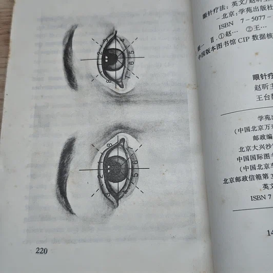 หนังสือ Eye Acupuncture Therapy รูปที่ 10