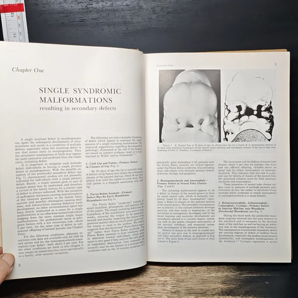 หนังสือ Recognizable Patterns of Human Malformation รูปที่ 9