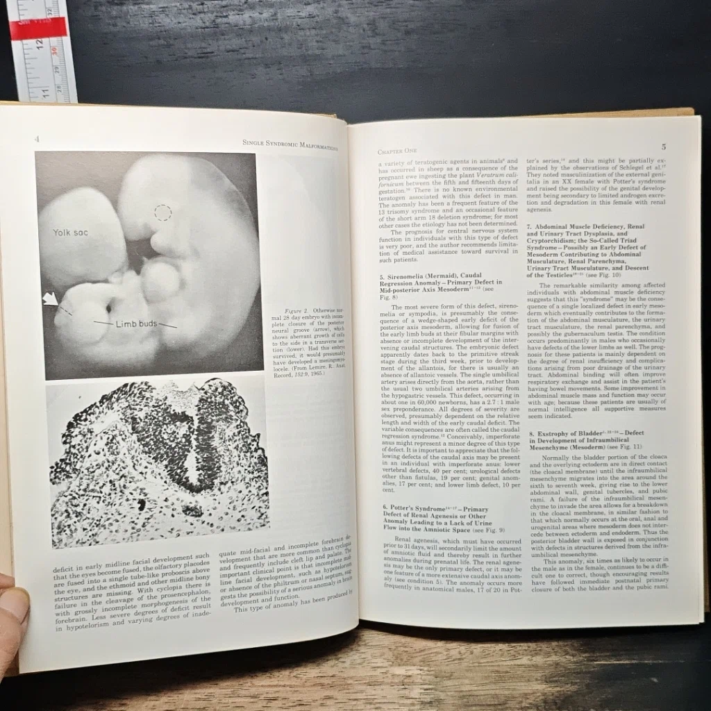 หนังสือ Recognizable Patterns of Human Malformation รูปที่ 10