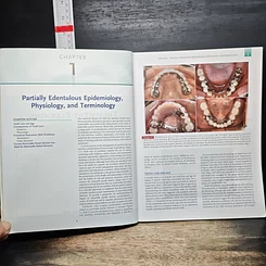 หนังสือ McCracken's Removable Partial Prosthodontics รูปที่ 9